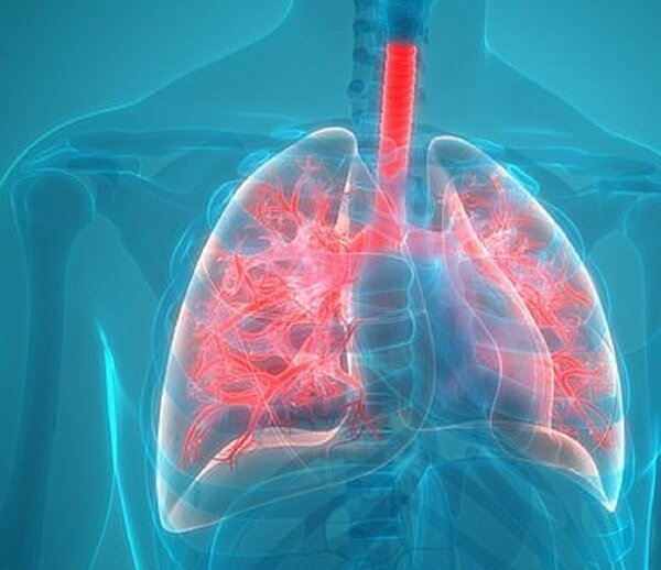 Bệnh viêm phổi